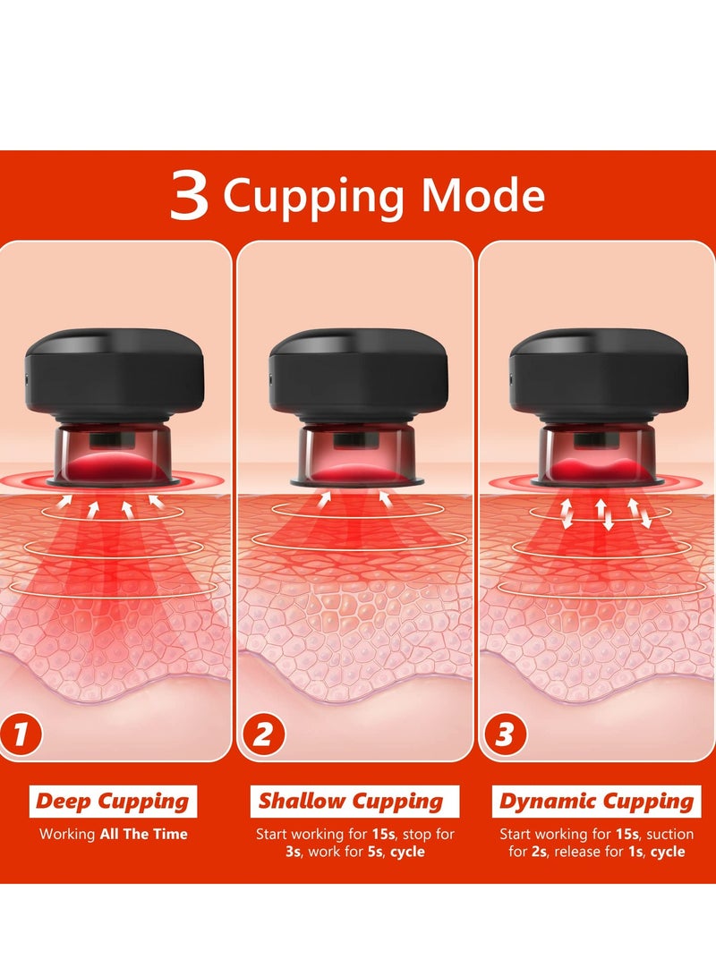 Smart Dynamic Cupping Therapy Set, Remote Control Cupping Set with Red Light Therapy for Pain Relief, Recovery, Smart Cupping Therapy Massager with 3 Mode, 16 Level Temperature and Suction