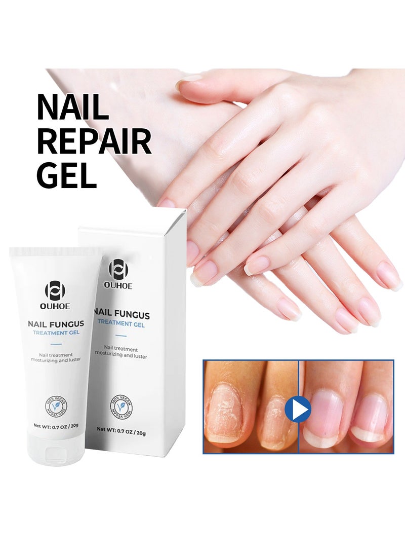 OUHOE Nail Care Gel Hand and Foot Onychomycosis Nail Shine Nail Repair Gel Soft Nail Thickening Type