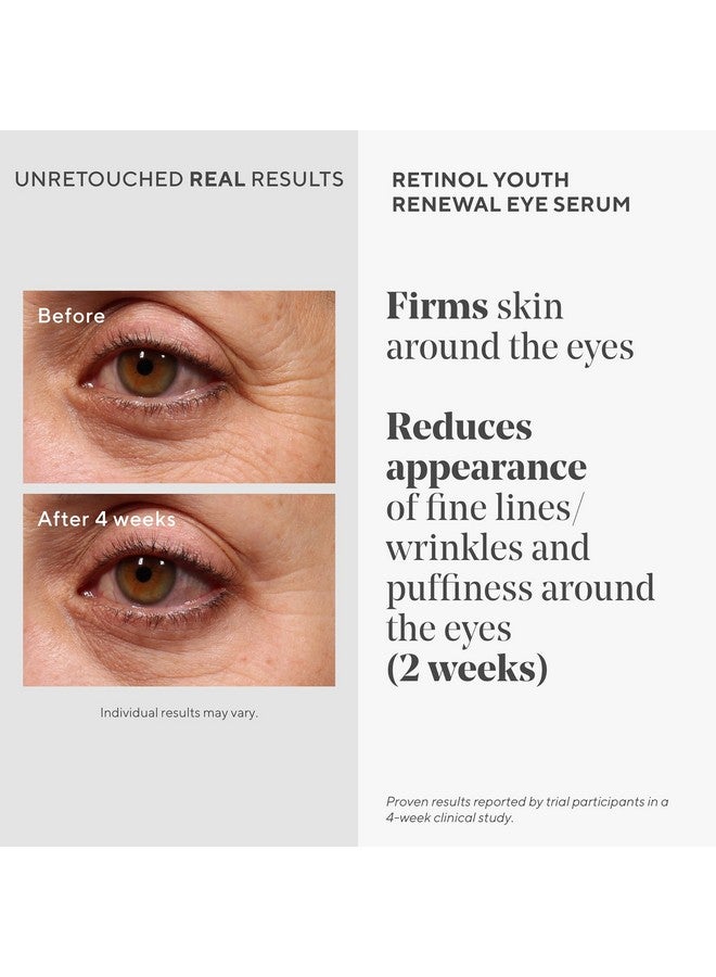 Retinol Youth Renewal Eye Serum Resurgence Reduces Crow’S Feet And Under Eye Lines And Wrinkles Gentle Antiaging Hydrating Hyaluronic Acid Treatment Backed By Science 0.5 Fl Oz