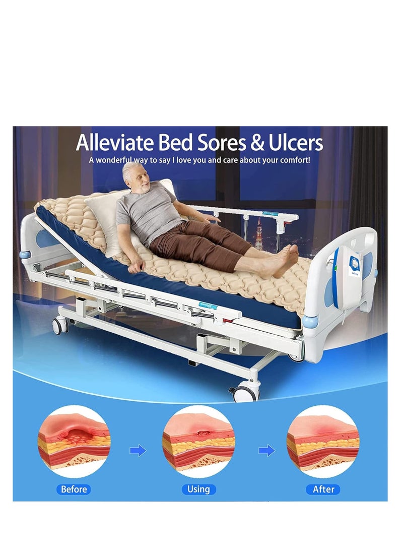 COOLBABY Silent Alternating Air Pressure Mattress With Mattress Cover And Pump Inflatable Silent Mattress To Prevent Bedsores And Sore Treatment For Bedridden Patients