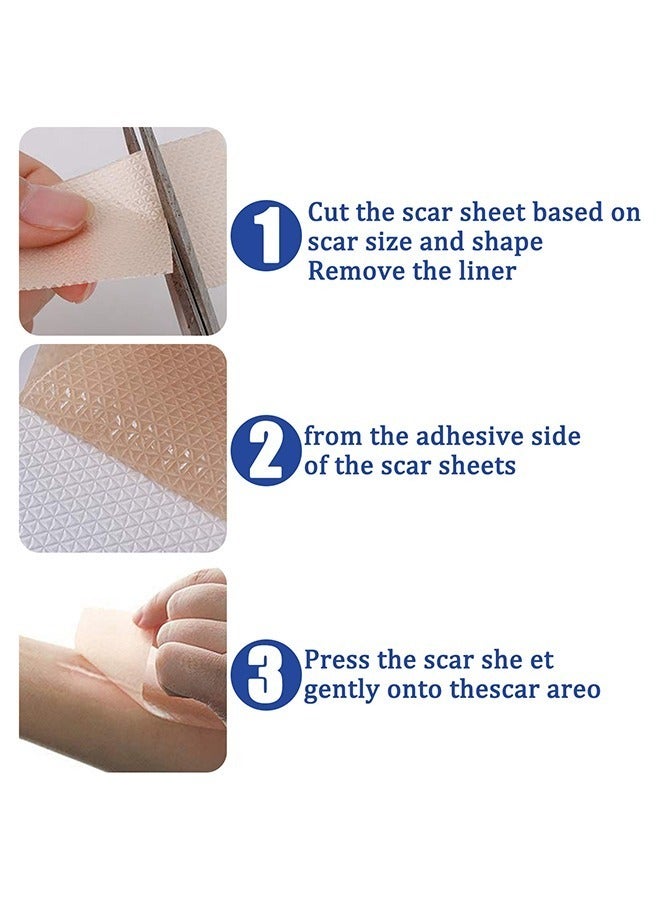 4PCS Professional Silicone Scar Sheets,Soft Silicone Gel Scar Tape Painless Silicone Tape Roll Effective Silicone Scar Removal Strips Sheets for C-Section & Keloid Surgery, Burn, Acne