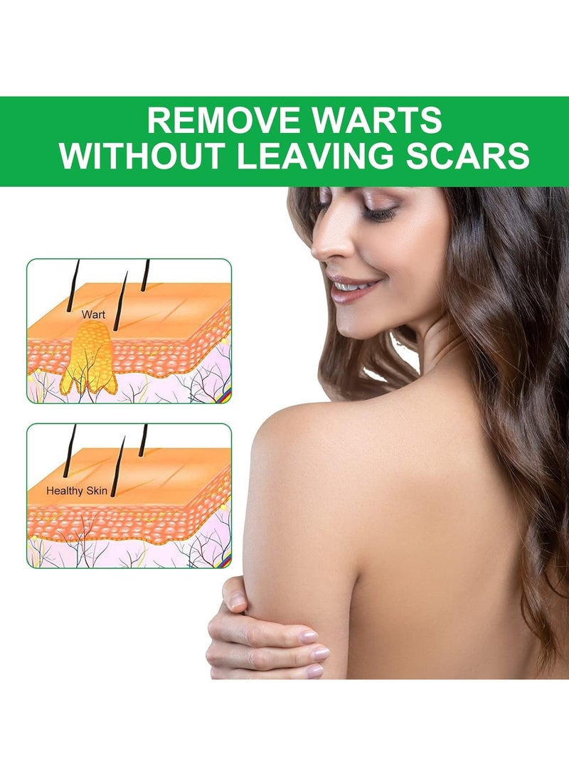 G Warts Skin Tag And Wart Removers