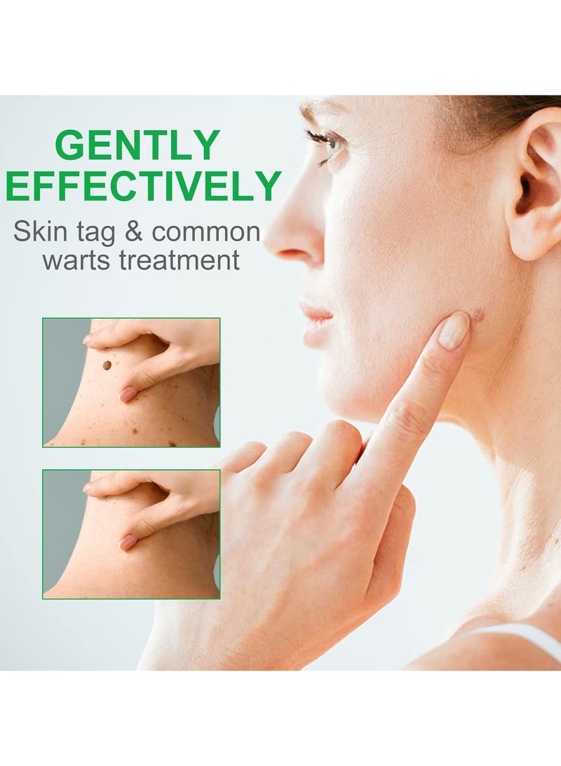 G Warts Skin Tag And Wart Removers