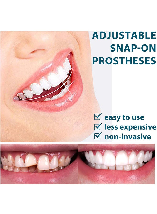 Adjustable Snap-On Prosthese, Cosmetic Denture Veneers For Upper And Lower Jaw, Denture Smile Teeth Customizable Temporary Perfect Fake Teeth Molds Braces For Snap In Instant And Confidence Smile