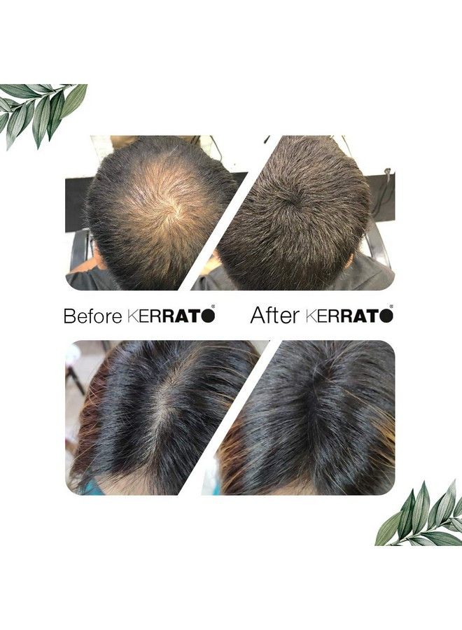 For Thinning Hair (Natural Black) Natural 28G Conceals Hair Loss In 10 Seconds Natural Hair Thickener & Fibre For Thin Hair For Men & Women