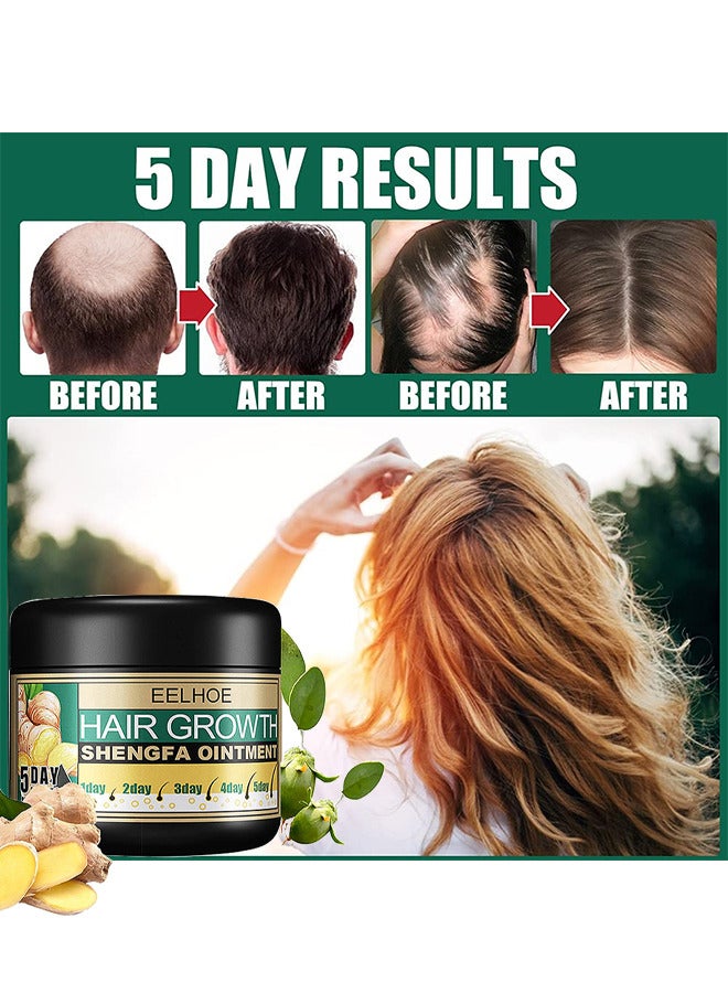 Ginger Hair Growth Shengfa Ointment, Ginger Germinal Conditioner, 5 Days Hair Regrowth Cream, Moisturizing Scalp Massage Follicle Ginger Essence Cream For Hair Loss And Hair Thinning Treatment