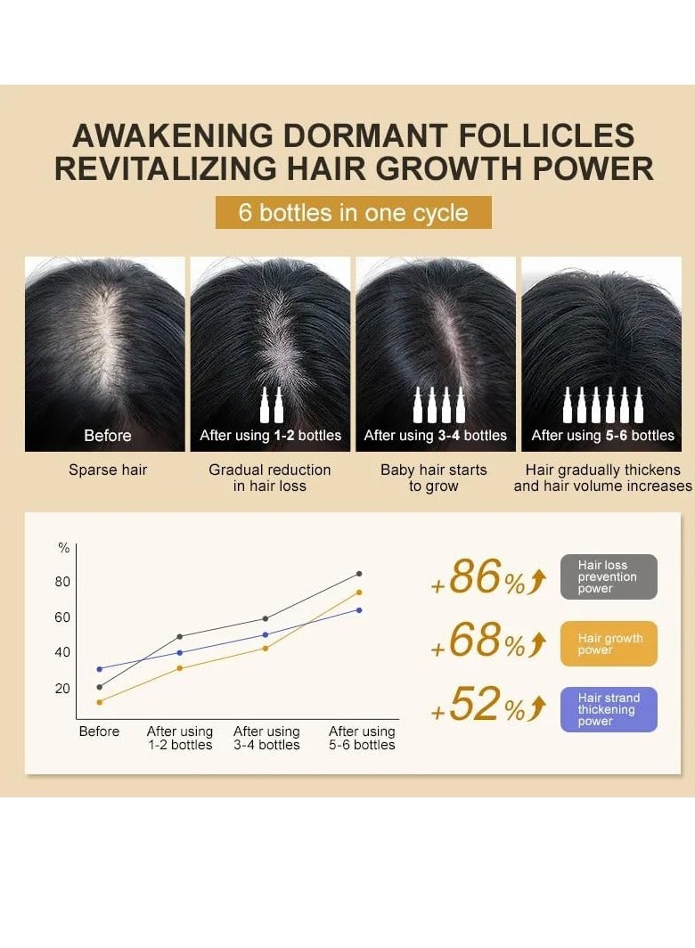 Anti Hair Loss and Hair Growth Spray 50000PPM Biotin and Collagen Hair Growth Spray Hair Thinning Treatment Reduce Hair Loss Thicken and Lengthen Hair Fragrance Deodorization Hair Growth Serum 30ml