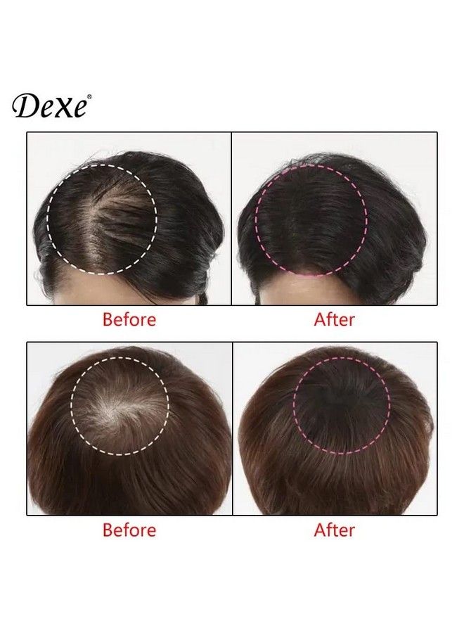 Dexe Root Cover Up 6Gm Instantly Cover Greys + Touch Up Highlights Create Thickerlooking Hairlines Waterresistant Sweatresistant Root Concealer (Black)