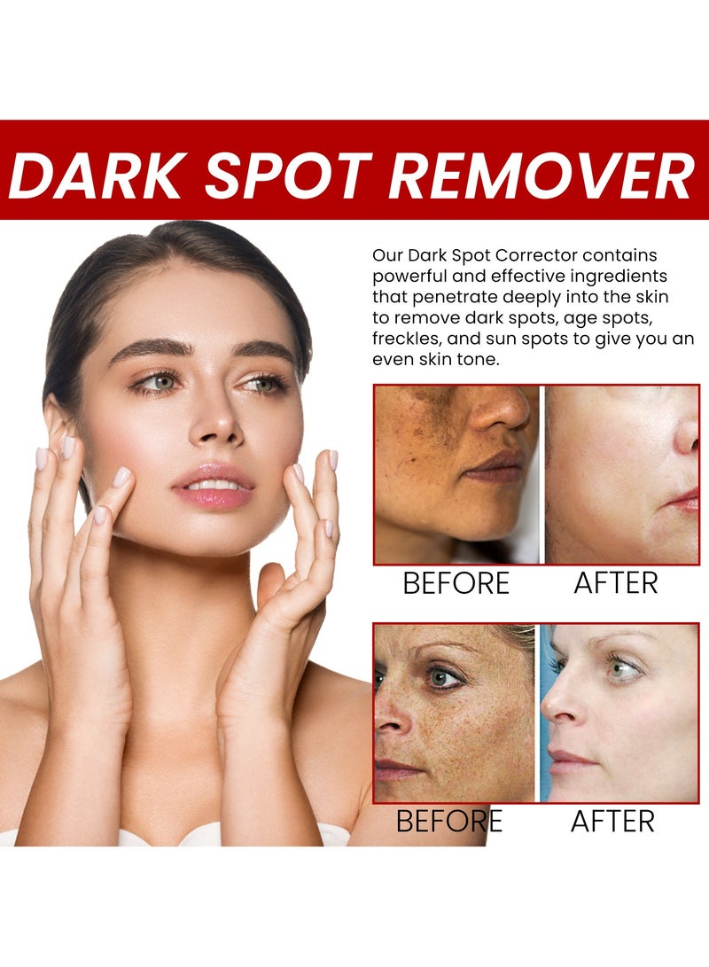 Dark Spot Remover Cream moisturizes hydrates and whitens the skin.