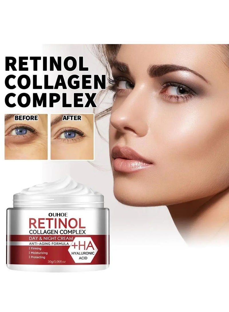 Retinol Cream, 30g Anti Aging Cream With Hyaluronic Acid And Collagen, Wrinkle Removal Skin Firming Cream, Retinol Moisturizer Cream For Skin Tightening, Dry Lines And Fine Lines