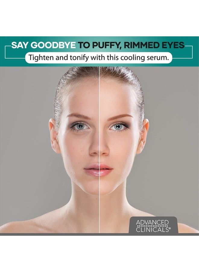 Puffy Eyes Treatment Eye Serum Anti Aging, Brightening, & Firming Under Eye Serum with Vitamin E, Collagen, Gotu Kola, Caffeine, & Green Tea Helps Hydrate & Calm Puffiness by Advanced Clinicals