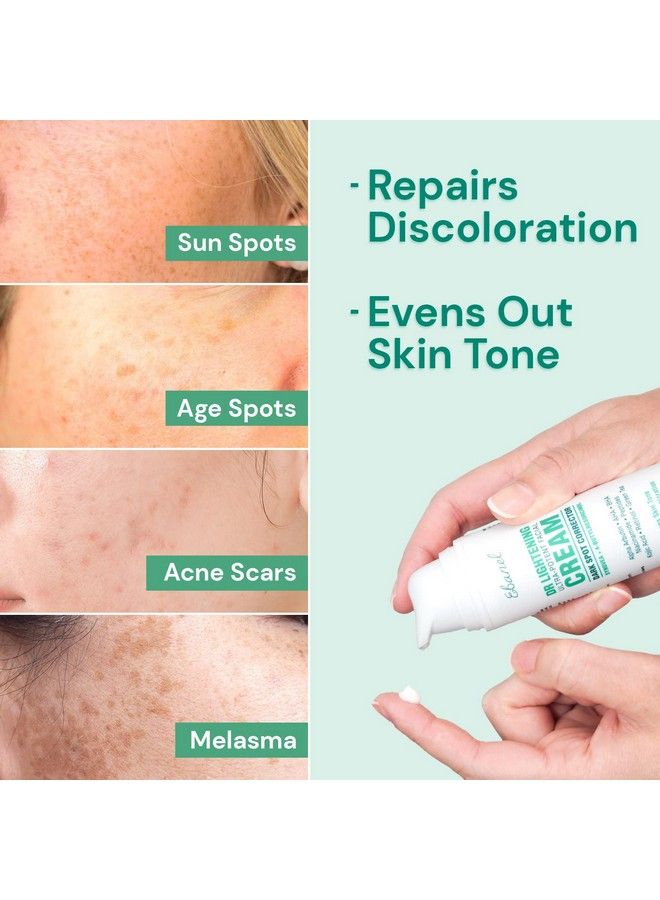 Dark Spot Remover For Face Peel Skin Brightening Cream Melasma Hyperpigmentation Treatment Sun Spot Age Spot Freckle Remover Fade Cream Synovea 4Butylresorcinol Niacinamide Glutathione