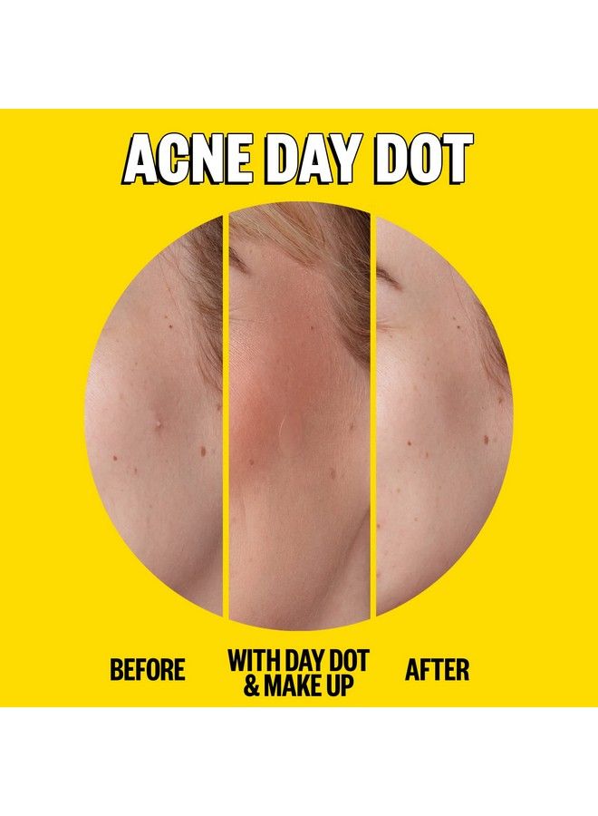 Skincare Acne Day & Night Duo | 6Hour Fast Acting Sheer Hydrocolloid Pimple Patches And Overnight Acne Dots With Salicylic Acid | Stickers To Cover And Clear Breakouts | (20 Dots)