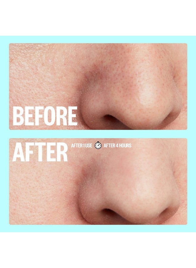 Eace Out Skincare Pores. Hydrocolloid Porerefining Nose And Face Strips With Vitamin A To Shrink Enlarged Pores And Remove Blackheads (4 Pore And 4 Nose Strips)