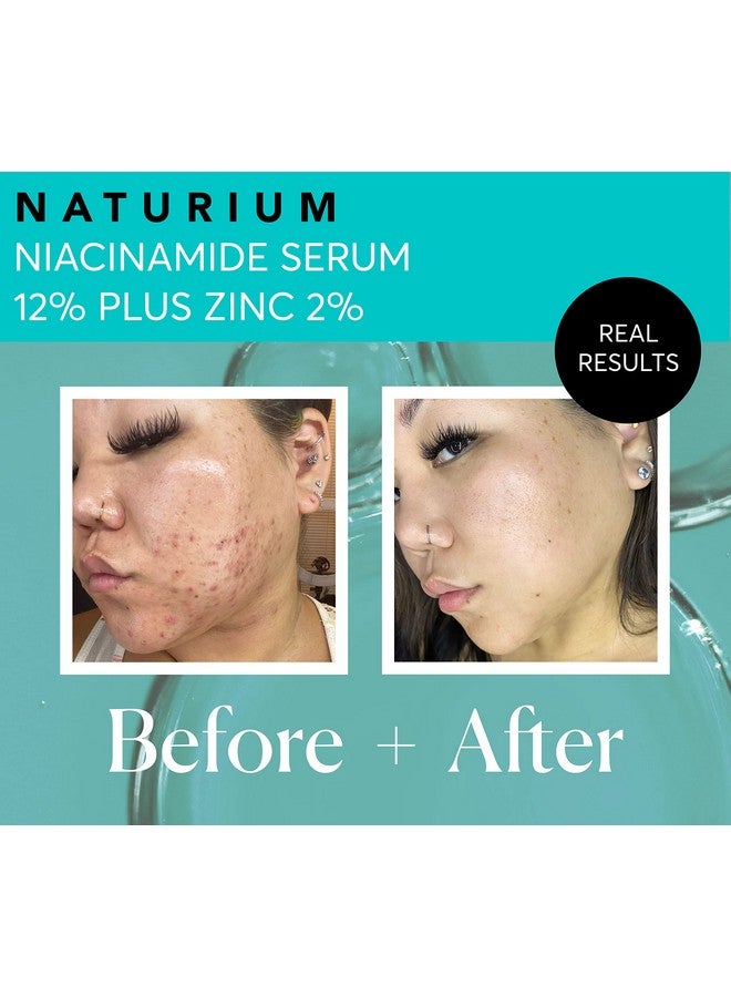 Aturium Niacinamide Face Serum 12% Plus Zinc 2% Skin Complexion Treatment & Pore Minimizer With Hyaluronic Acid & Vitamin E 1 Oz