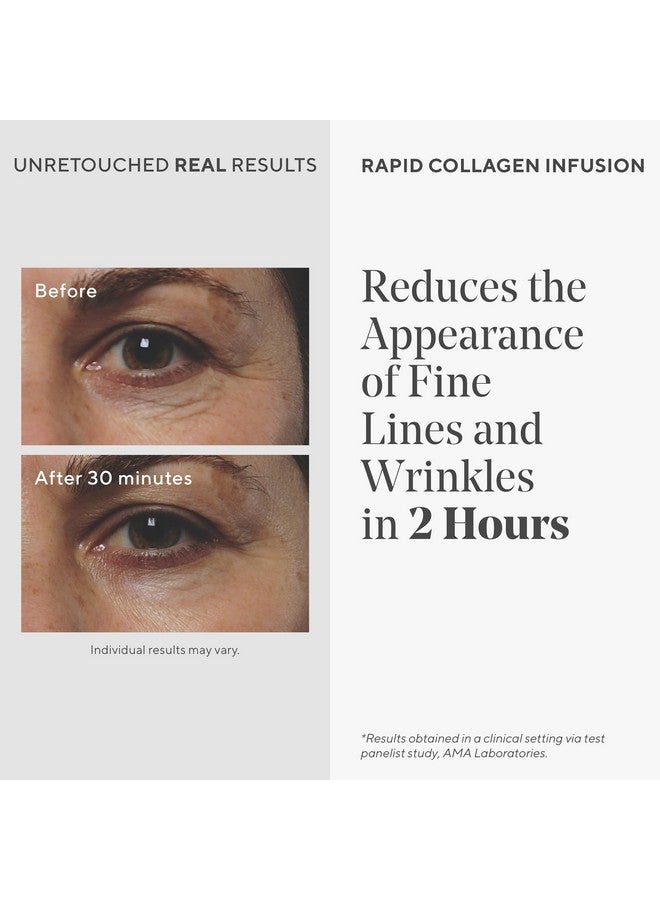 Urad Rapid Collagen Infusion Resurgence Antiaging For Face Skin Smoothing Cream Targets Deep Wrinkles Gentle Skin Treatment Backed By Science 1.0 Oz