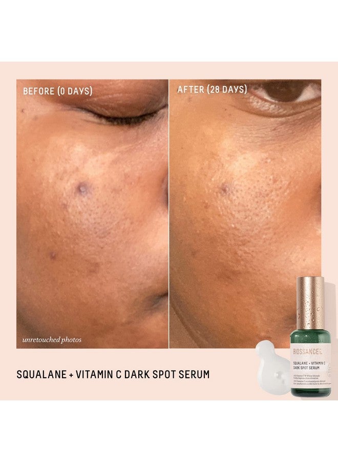 Squalane + Vitamin C Dark Spot Serum. Powerful Lightweight Serum With 10% Vitamin C To Brighten Skin Fade Dark Spots Reduce Pigmentation And Prevent Discoloration (1.01 Ounces)