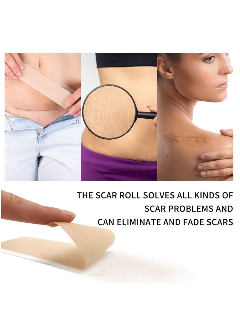 Silicone Scar Sheets Roll (3m) Silicone Tape Roll Removal Scar Patches Also Reusable With Great Adhesion