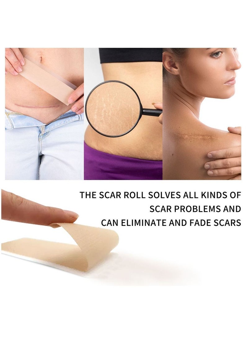 Advanced Silicone Scar Sheets Roll (3m) Silicone Tape Roll Removal Scar Patches Also Reusable With Great Adhesion