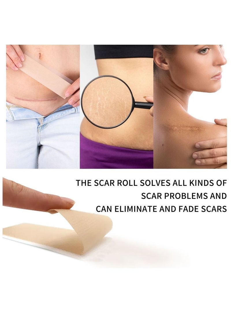 Advanced Skincare Professional Medical Grade Silicone Scar Sheets for C-Sections, Reusable Sheets for Hypertrophic and Keloid Scars,Removes Scars from Injury, Burn, Pregnancy,Surgery