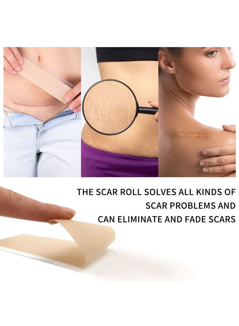 Silicone Scar Sheets Roll Silicone Tape Roll Removal Scar Patches Also Reusable With Great Adhesion (3m)