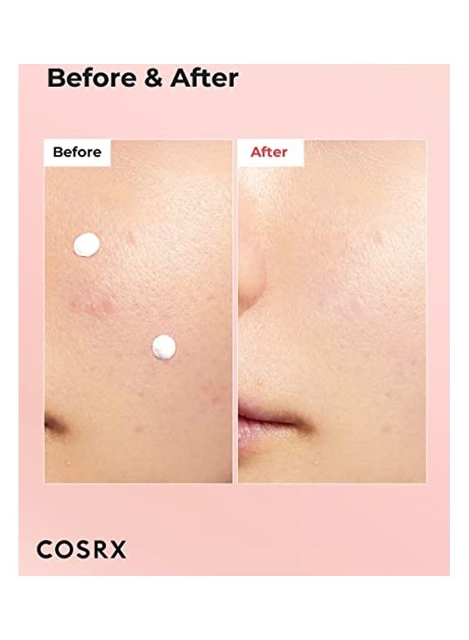Acne Blemish Spot Drying Lotion 30ml