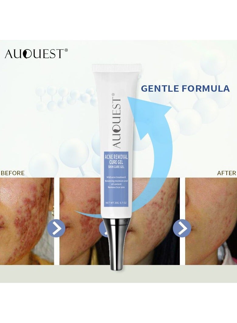 AUQUEST spot gentle repair acne pits and acne marks, fade blackheads, pores, moisturizing acne gel cream