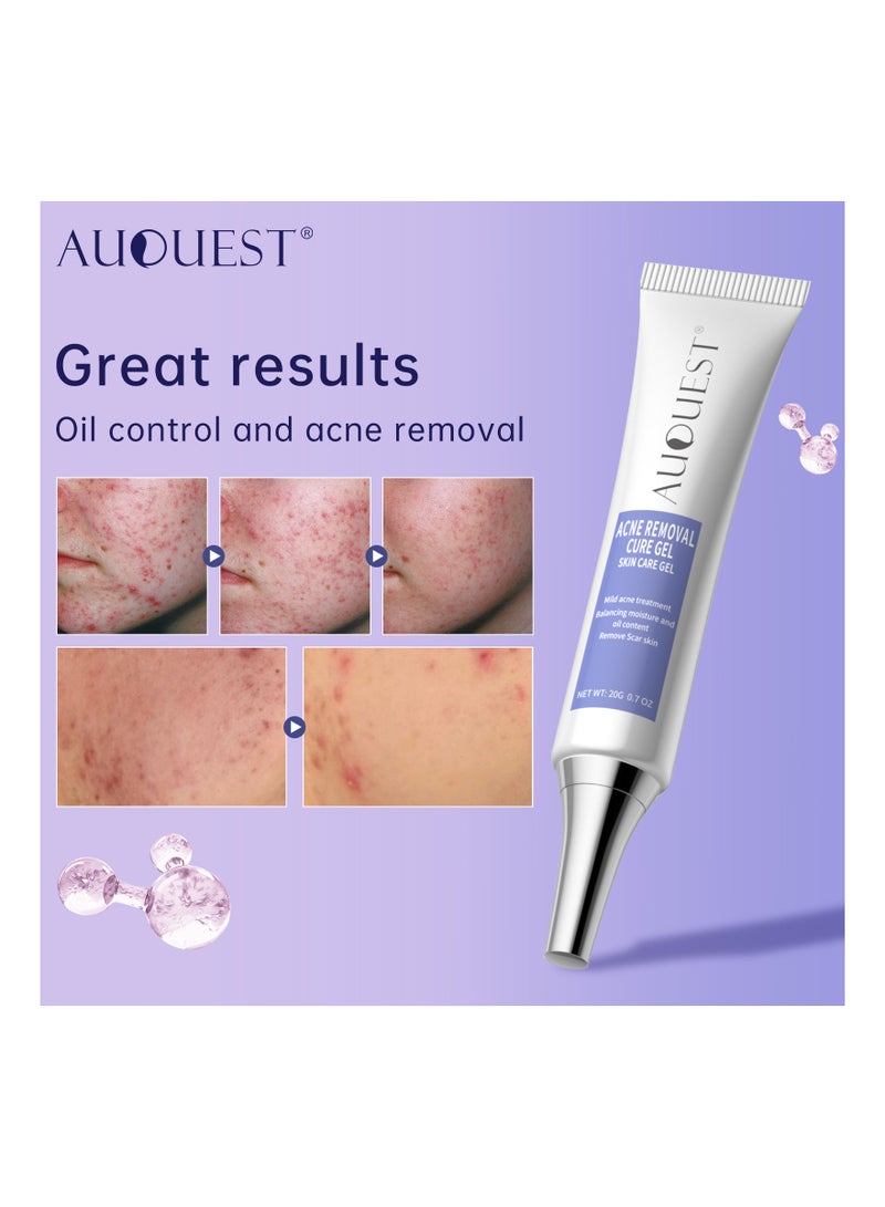 Herbal Acne Treatment Cream Pimple Spot Removal for Teens Oil Control Acne Scar Gel Shrink Pores Skin Care Beauty Health