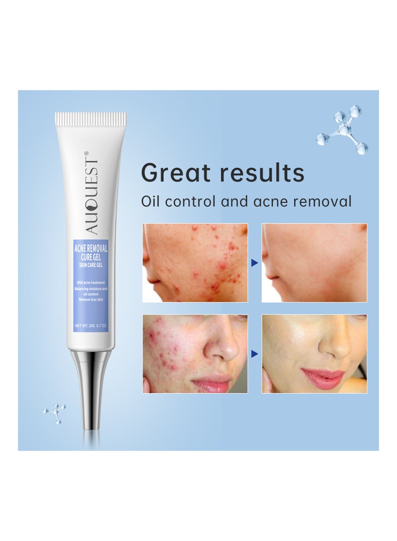 Herbal Acne Treatment Cream Pimple Spot Removal for Teens Oil Control Acne Scar Gel Shrink Pores Skin Care Beauty Health