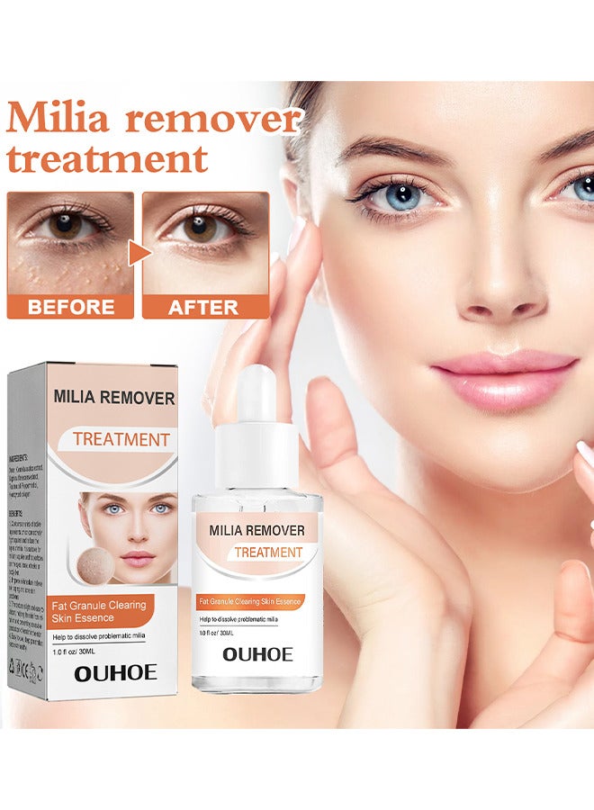 Milia Removal Treatment, Milia Spot Treatment Helps Dissolve And Reduce Milia, Whitehead And Sebaceous Hyperplasia, Cysts And Sebaceous Hyperplasia Face Serum 30 ML