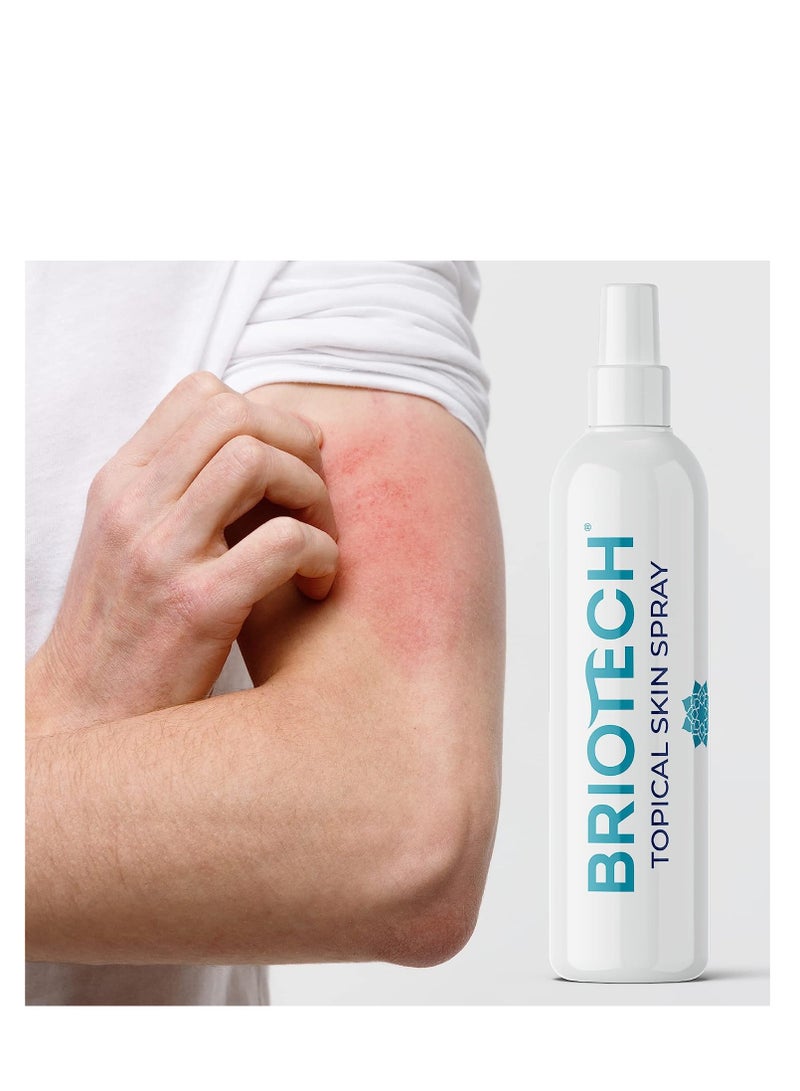 Briotech hypochlorous acid spray topical skin face & body mist support irritations soothe redness dry skin & scalp athletic itch packaging may vary 4 fl oz / 120 ml