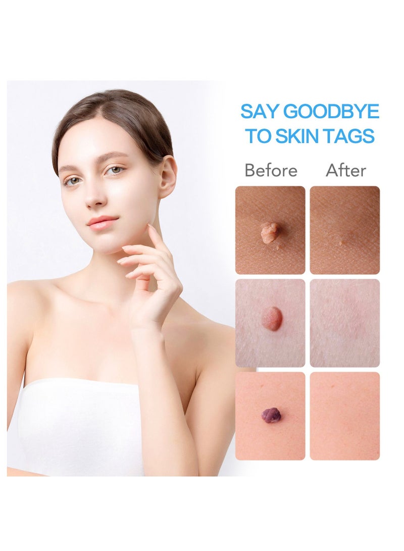 2 in 1 Skin Tag Remover Kit Fast and Easy Skin Tag Remover Painless Skin Tag Removal Kit for Small to Medium Skin Tags (1mm - 9mm) Safe for Most Body Parts