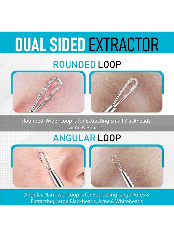 Blackhead Remover Pimple Extractor Popper Tool Acne Comedone Blackhead Blemish Whitehead Popping Zit Removing For Nose Face 304 Stainless Steel