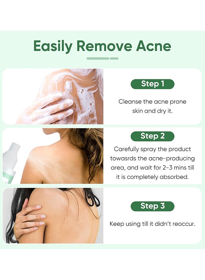 120ML Back Acne Treatment Soothing Spay, Back Acne Spray, Niacinamide Spray, Body Acne Treatment with Herbal Formula, Tea Tree Oil Spray, Body Acne Treatment Spray For Teens, Gentle On Skin