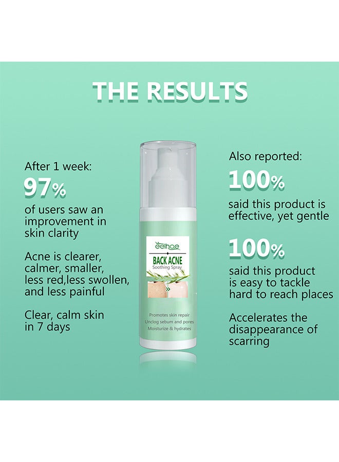 120ML Back Acne Treatment Soothing Spay, Back Acne Spray, Niacinamide Spray, Body Acne Treatment with Herbal Formula, Tea Tree Oil Spray, Body Acne Treatment Spray For Teens, Gentle On Skin