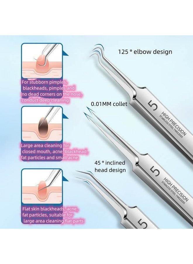 Professional Facial Blackhead Remover Tweezersextractor Acne Removal Kit Pimple Popper Tool Clip For Whiteheads Acne Clip Ingrown Hairs Tweezers Blackheads Remover Extractor Stainless Steel