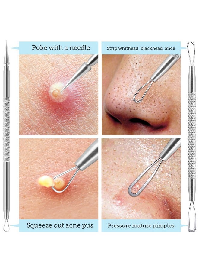 Pore Prep Tool Blackhead Remover Pimple Popper Tool Kit Stainless Steel Blackhead Extractions Tool For Acne Whitehead Popping Blemish Comedone