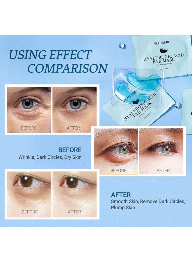 Under Eye Patchs (30 Pairs) Hyaluronic Acid Eye Mask For Dark Circles And Puffiness Wrinkle Eye Bags (Hyaluronic Acid)