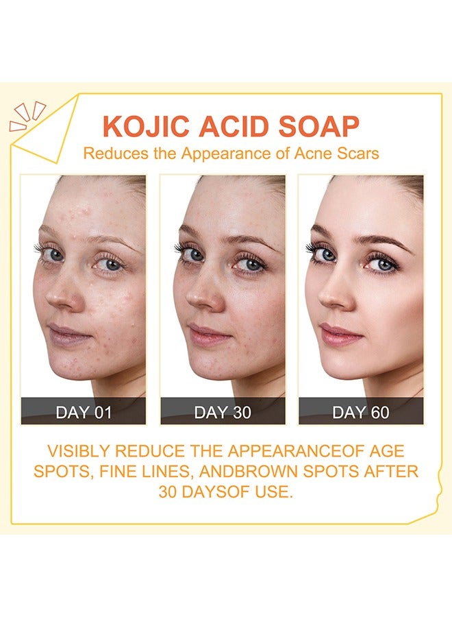 Kojic Acid Soap For Hyperpigmentation, Kojic And Papaya Soap For Brighter Skin, Reduce Acne, Cleanse Scars And Even Skin Tone, Bath Soap For Face And Body, Keep Skin Moist, Smooth, Shiny 100G