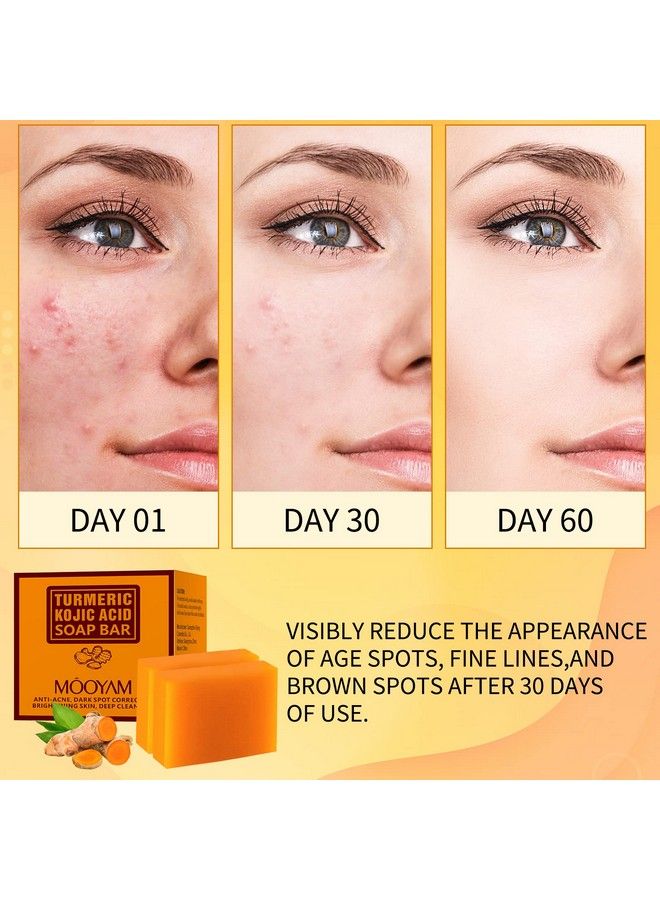 Koji Acid Soap For Dark Spots Turmeric Soap For Face And Body Kojic Acid Soap Skin Brightening Tumeric Soap For Acne Dark Spots Hand Soap Bar Acne Face Wash Turmeric Kojic Soap Clear Skin 200G/7Oz