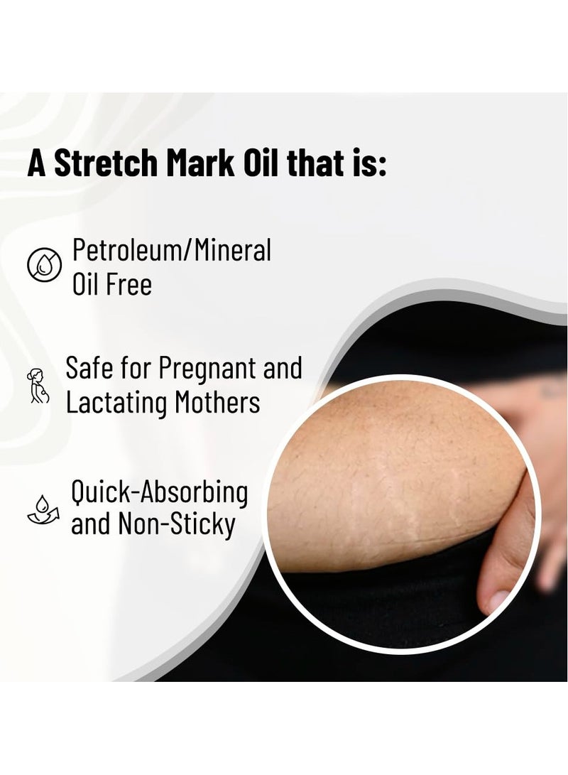 Chemist at Play Stretch Mark Scar Fading Oil Enriched with 10 Natural Oils Like Almond Rosemary Rosehip Oils More Vitamin C E