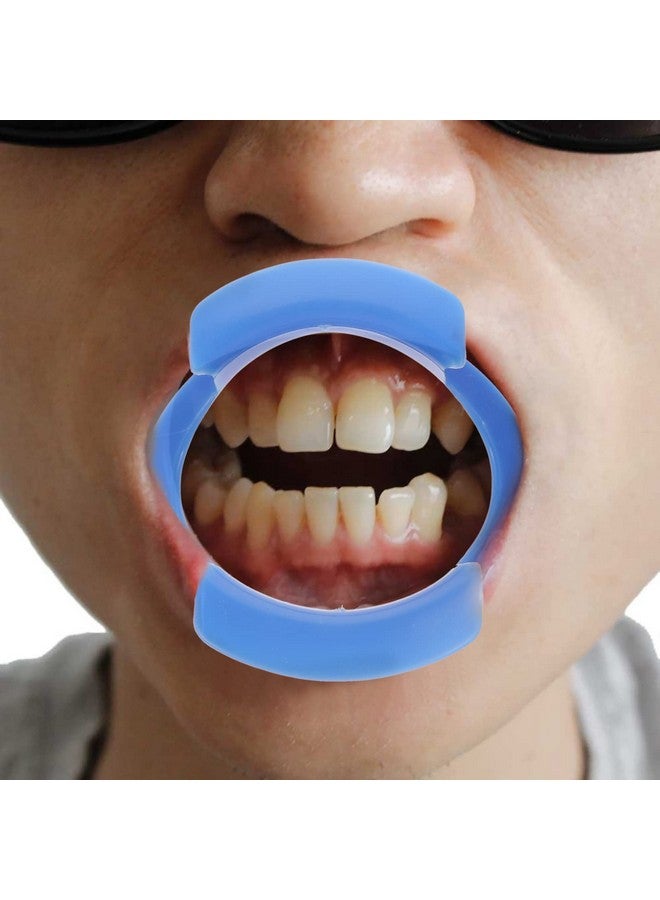 2Pcs O Oral Watch Speak Orthodontics Tool Lipless Shape For Mouthguard Teeth White Orthodontic Opening Game Fun Ya Opener Blue Block Device Mouth Intraoral Autoclavable Cheek