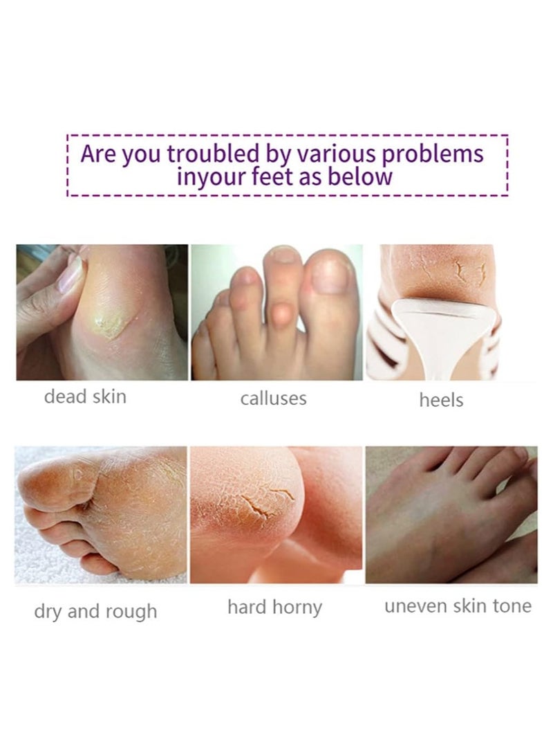 Foot Peel Mask 5 Pack, Exfoliating Foot Masks, Natural Exfoliator for Dry Dead Skin, Callus, Repair Rough Heels for Men Women