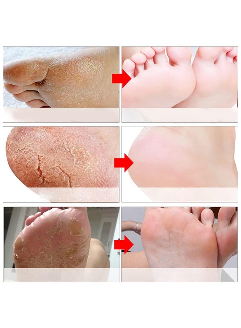 Foot Peel Mask 5 Pack, Exfoliating Foot Masks, Natural Exfoliator for Dry Dead Skin, Callus, Repair Rough Heels for Men Women