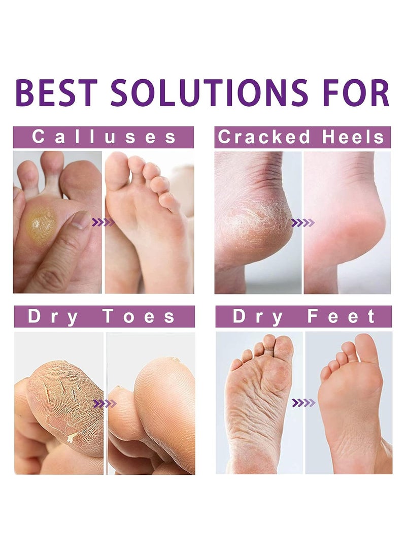 Foot Peel Mask 3 Pairs Exfoliating Foot Mask for Calluses, Dry ed Heels and Dead Skin, Moisturize Repair Rough Foot with Natural Ingredients, Feet Peeling Mask for Women & Men, Lavender Scent
