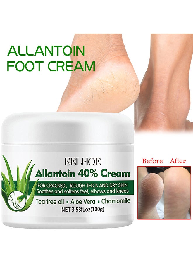 Foot Care Cream Allantoin 40% Cream For Cracked, Rough Thick And Dry Skin Soothes And Softens Feet, Elbows And Knees Hydrating And Moisturizing Foot Care Cream