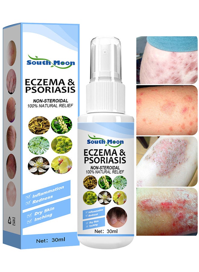 Natural Chinese Herbal Eczema And Psoriasis Spray, Dermatitis And Eczema Pruritus Psoriasis Spray, Say Goodbye To Scaly Skin, Eczema Relief Spray, Stops Burning And Itching 30ML