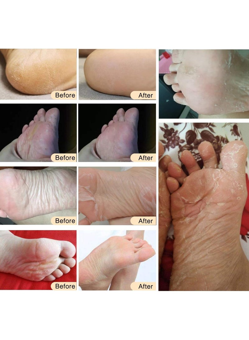5 Pairs Foot Peel Mask, Exfoliating Callus Peel Booties, Peeling Off Calluses & Dead Skin, Baby Soft Smooth Touch Feet-Men Women (Rose)