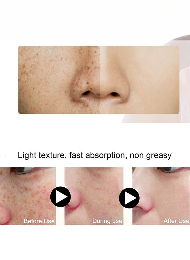 Whitening Freckle Cream,Dark Spot Corrector Remover Cream Whitening Moisturizing Brighten Complexion Improving Skin Barrier 20g