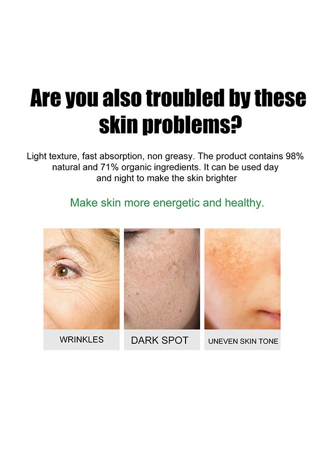 Whitening Freckle Cream,Dark Spot Corrector Remover Cream Whitening Moisturizing Brighten Complexion Improving Skin Barrier 20g